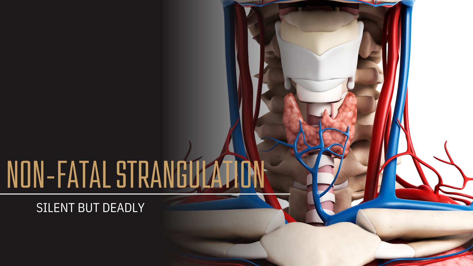 Non-Fatal Strangulation